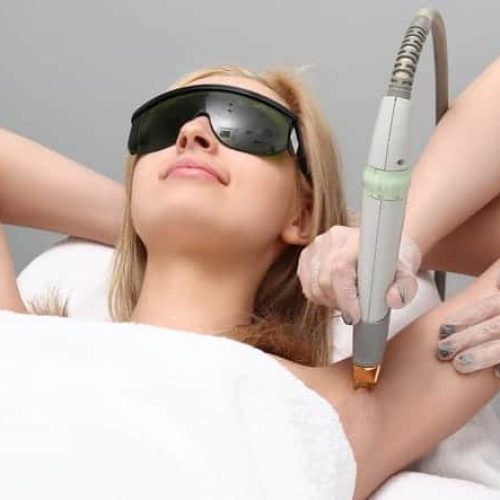 6 Laser Hair Removal FAQs